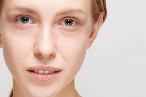 Undereyecircles